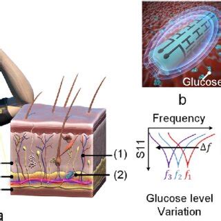 Subcutaneously implantable electromagnetic biosensor system 